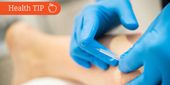 Dry-Needling_760x427_SclMd