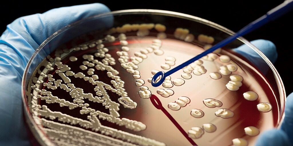 Petri dish with bacteria